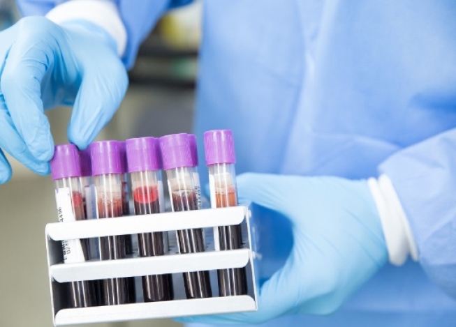 Anvisa aprova novo teste de covid desenvolvido no Brasil