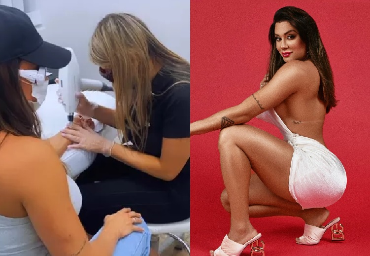 Juju Salimeni finaliza remoção de tatuagem com nome de Felipe Franco