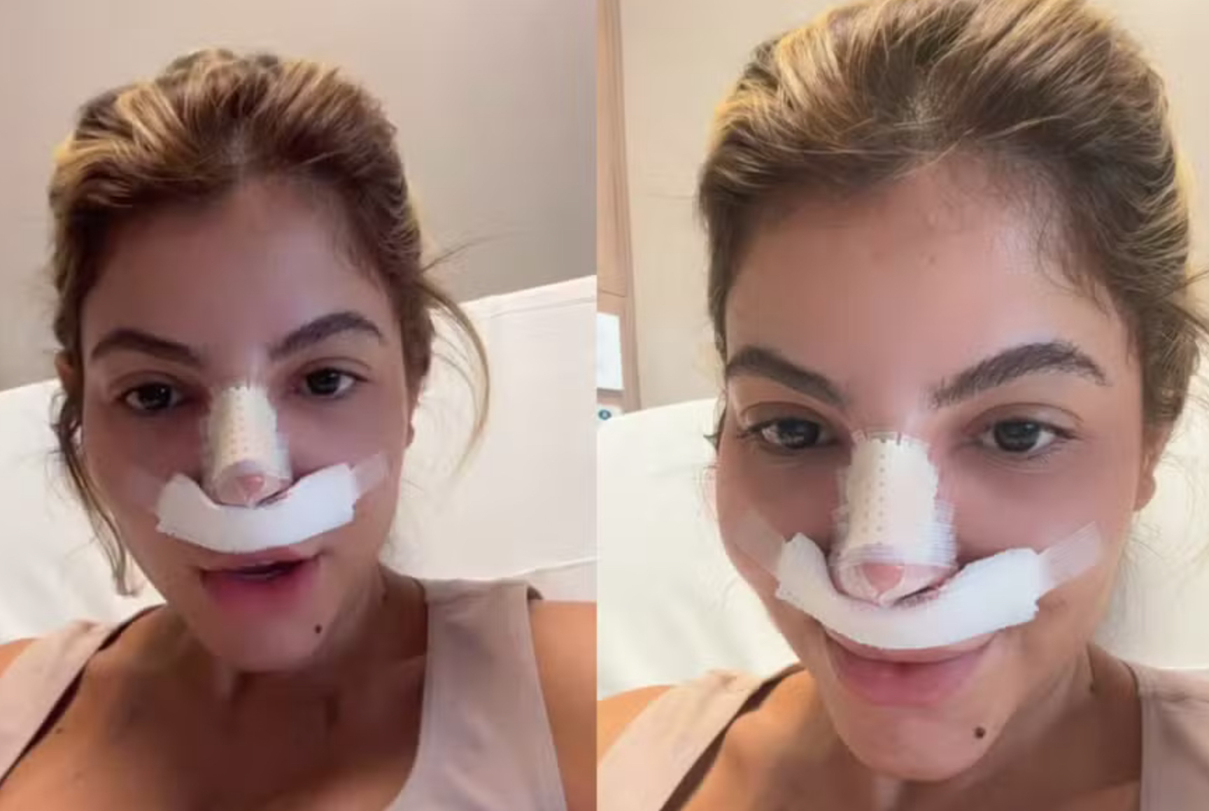 Ex-BBB Hariany mostra resultado de rino e mastopexia: ‘pressão estética’