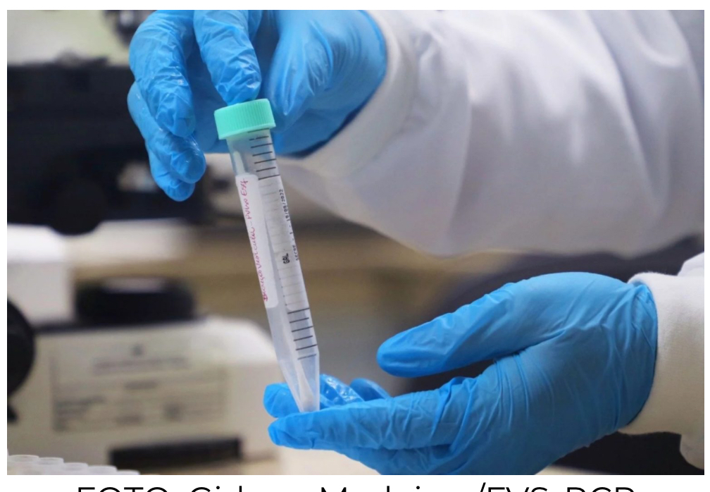 Sobe para 21 o número de casos confirmados de Mpox no Amazonas