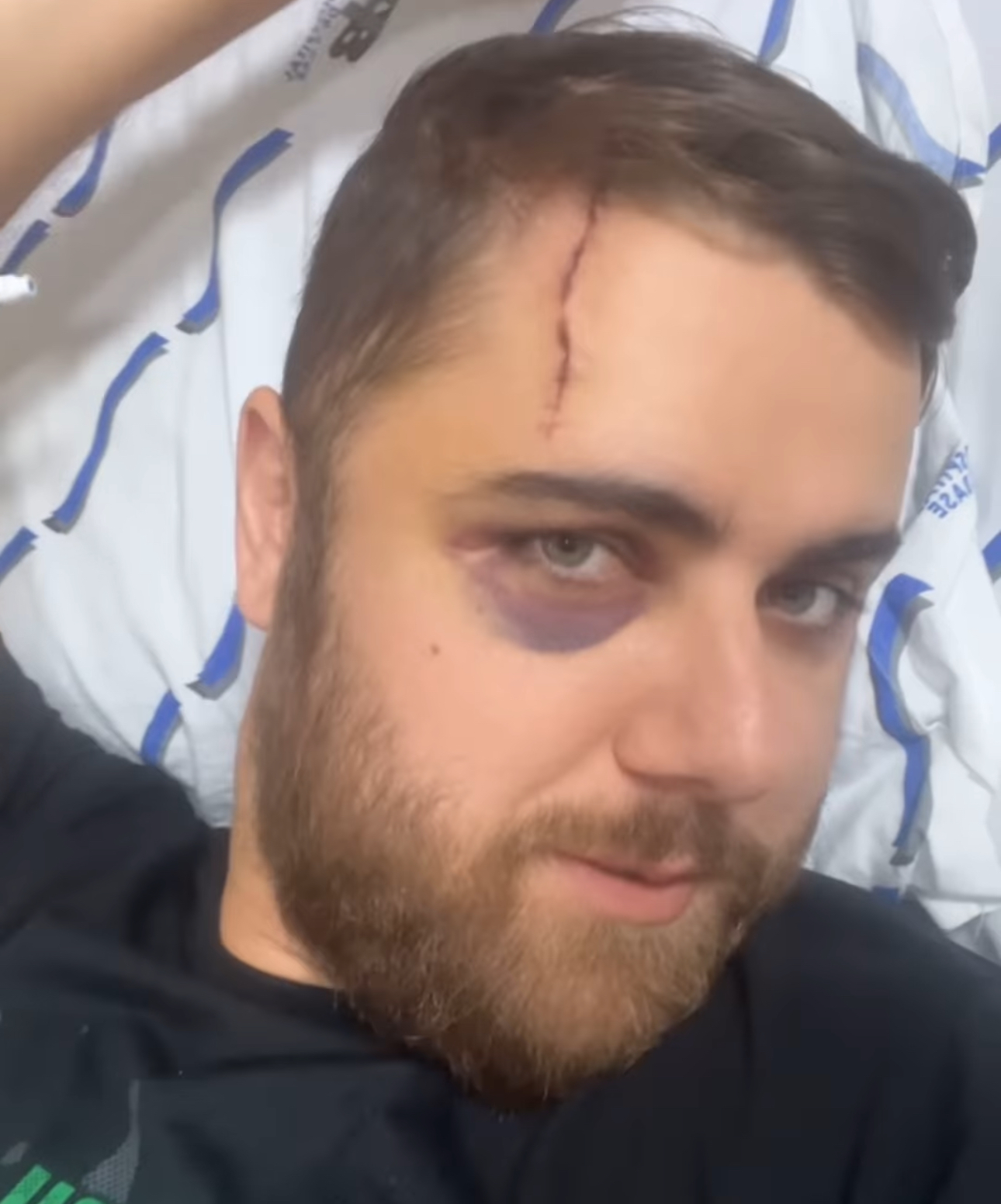 Internado, Zé Neto fala sobre estado de saúde após acidente 