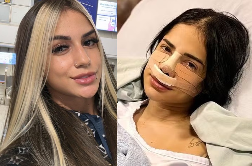 Influencer tira cartilagem da costela para rinoplastia e reclama de dores
