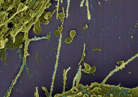 Nova cepa do coronavírus se espalha e chega à França e Suécia