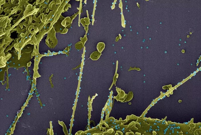 Nova cepa do coronavírus se espalha e chega à França e Suécia
