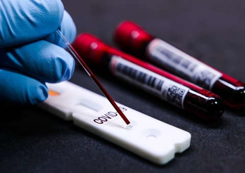 Estados Unidos têm o primeiro caso confirmado de reinfecção de Covid-19