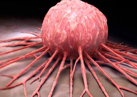 Primeiro homem curado do HIV enfrenta câncer terminal 