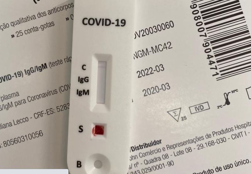 Japão exige teste de covid após caso de brasileiros infectados no AM