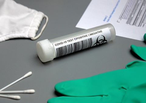 Mulher tem vazamento de fluído cerebral após fazer teste para Covid-19