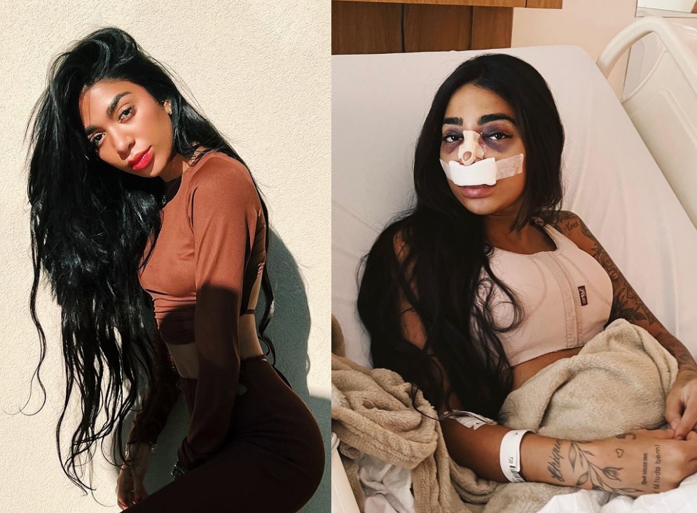 Irmã de Gabigol chora ao ver resultado de plástica no nariz