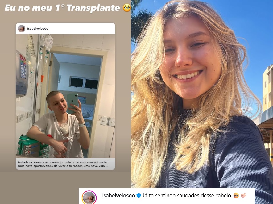Isabel Veloso conta que vai voltar a ficar careca após novo transplante