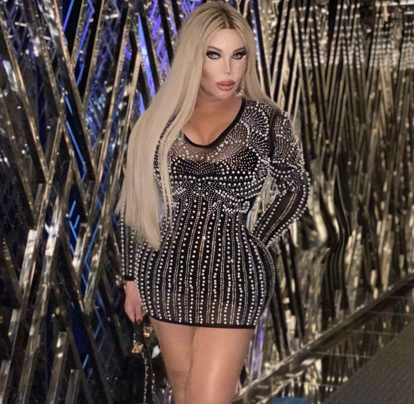 Ex-Ken Humano, Jéssica Alves faz cirurgia bariátrica 