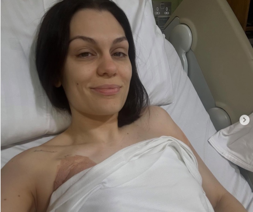 Com câncer, Jessie J passa por cirurgia 