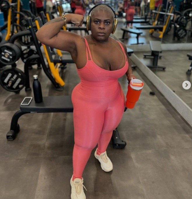 Saiba detalhes e quanto custou cirurgia plástica de Jojo Todynho