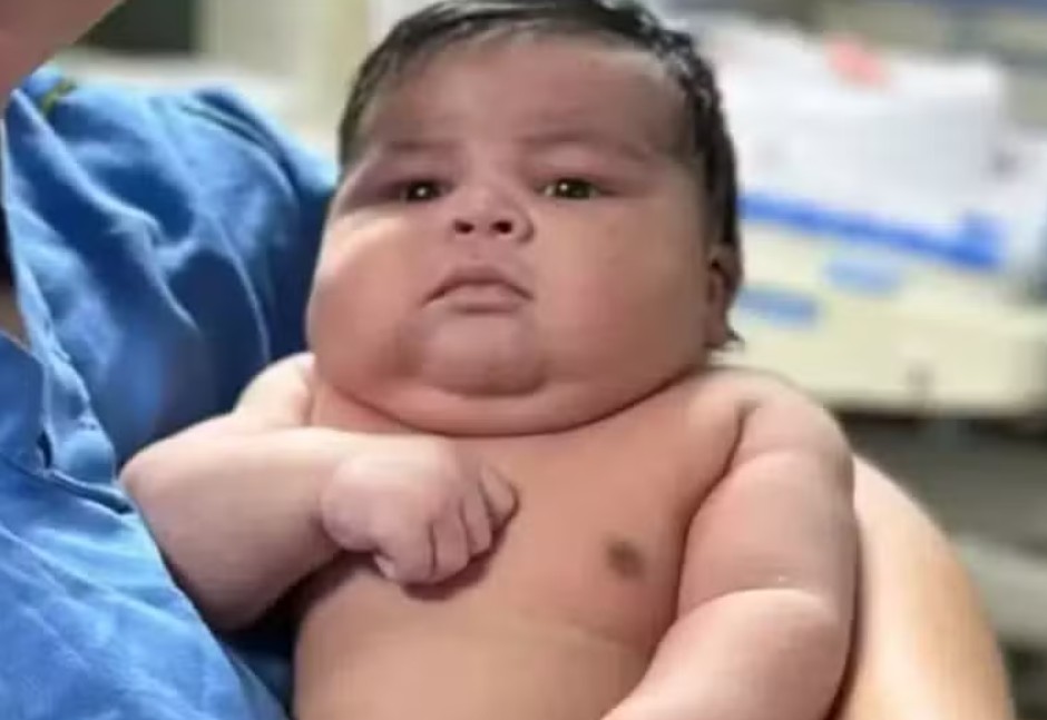 Mãe de bebê de 6,5 kg é submetida a parto normal e sofre hemorragia grave