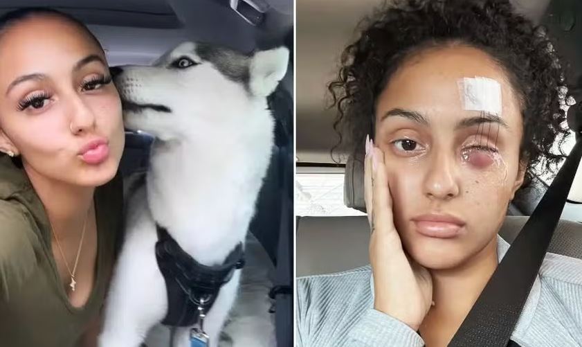 Mulher perde olho após guia de cachorro se soltar durante passeio