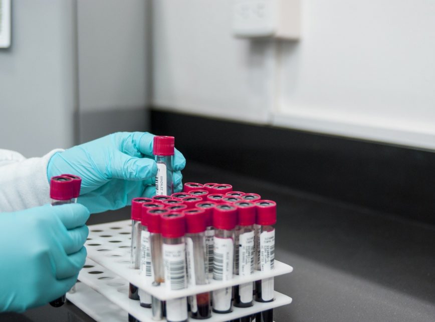 Variante delta preocupa, mas P.1. ainda predomina no Brasil, diz Fiocruz