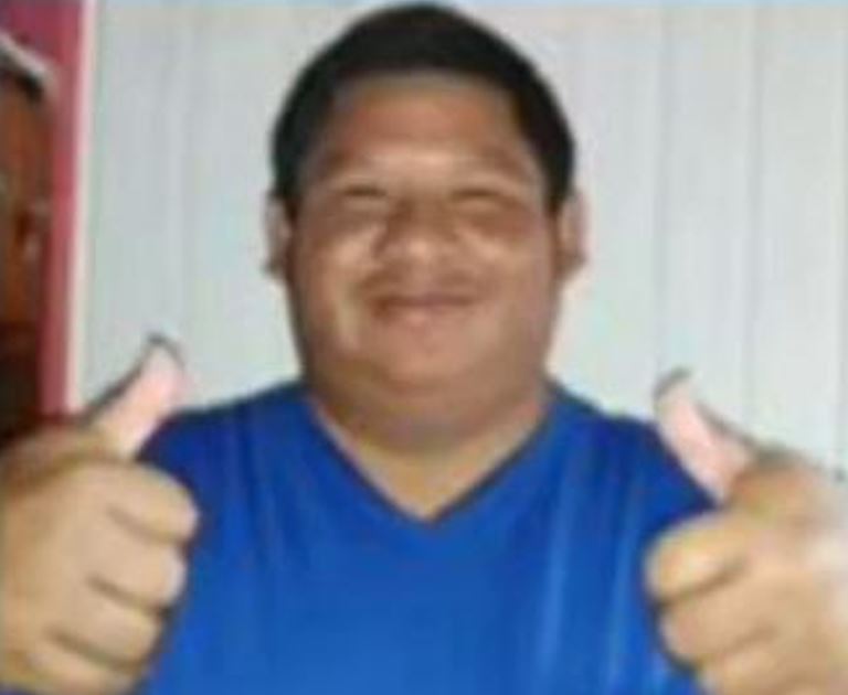 Peixeiro é baleado na cabeça ao ser atacado por pistoleiro no Amazonas