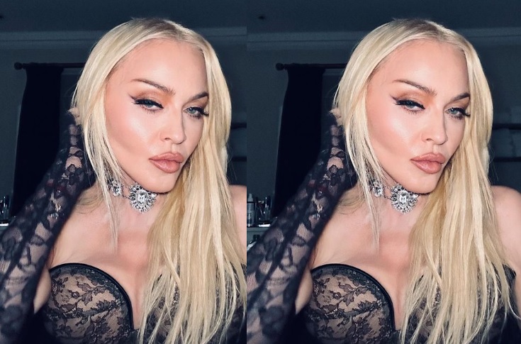 Saiba por que Madonna evita se expor ao sol 