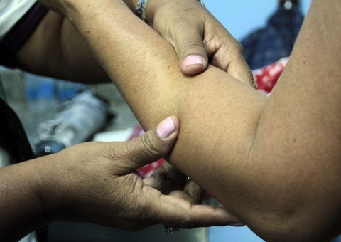 Busca por pacientes com hanseníase tem avaliação positiva da Semsa