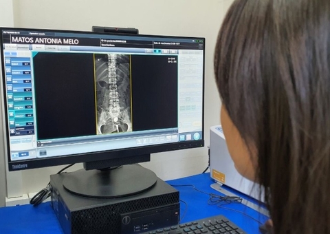 Vítimas de acidente de trânsito custam R$ 1,6 milhão a hospitais de Manaus