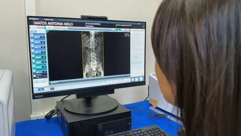 Vítimas de acidente de trânsito custam R$ 1,6 milhão a hospitais de Manaus