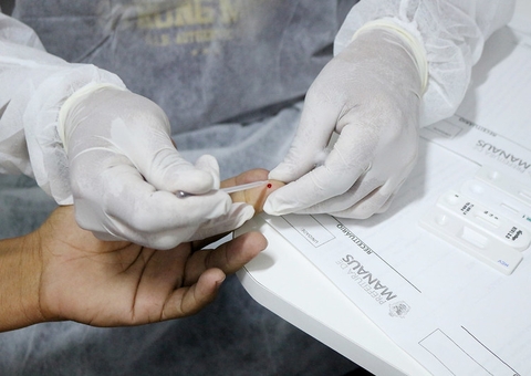 Com mais de 2,6 mil casos, começa campanha contra sífilis em Manaus