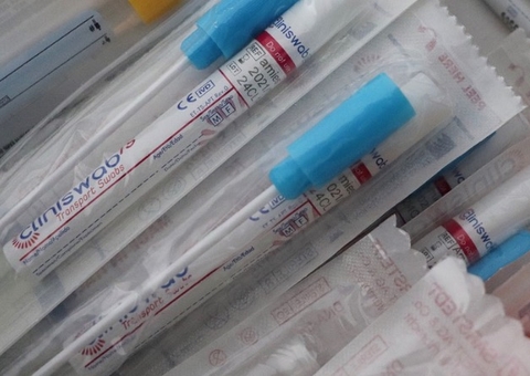 Amazonas contabiliza 996 novos casos de coronavírus em 24 horas