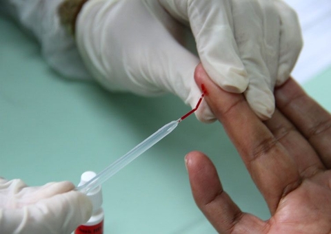 Serviço de telemonitoramento de tuberculose chega a Manaus