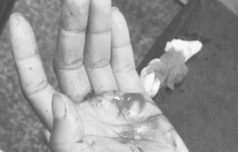 Homem é preso em hospital após esfaquear esposa em Manaus