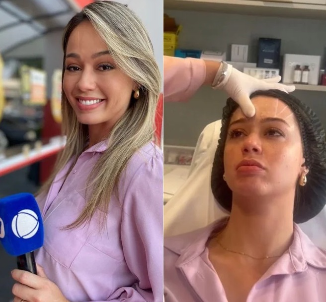 Record demite jornalista por fazer publi de botox