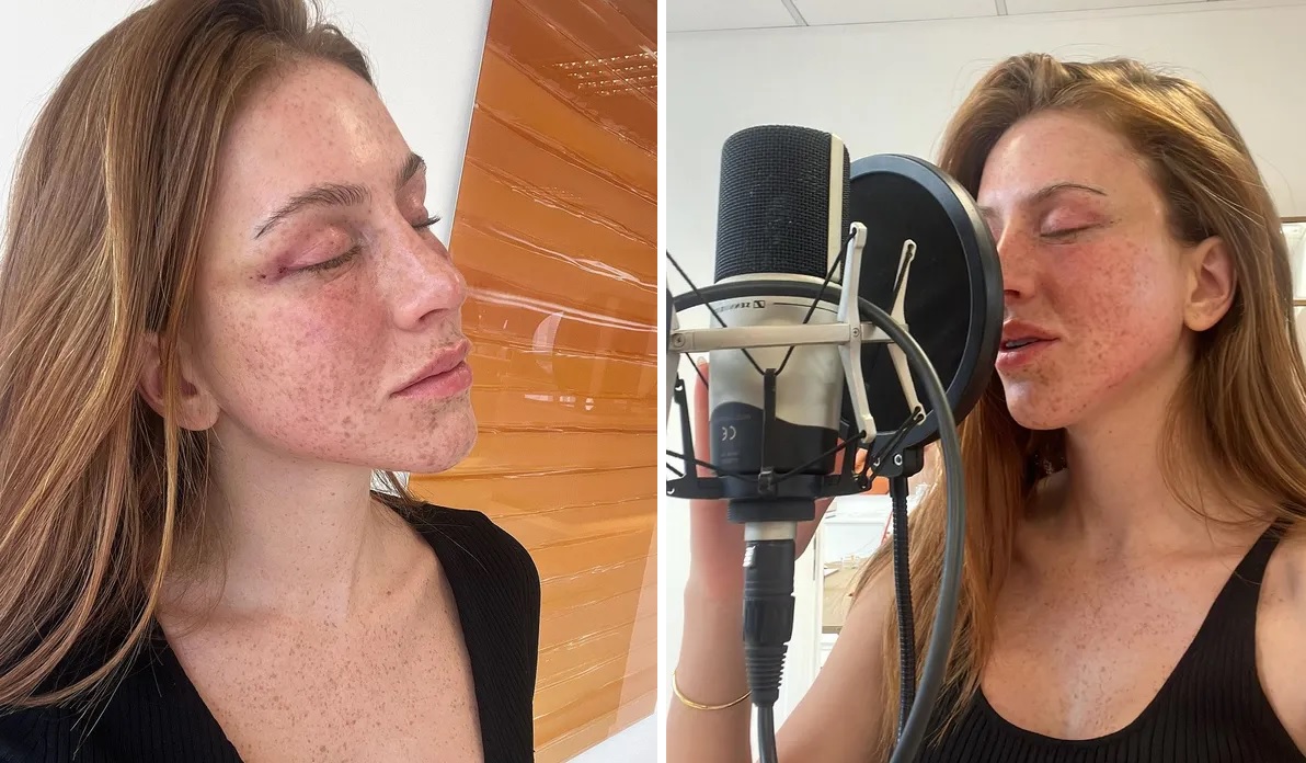  Mari Maria faz procedimento para ‘alongar os olhos’ e mostra resultado