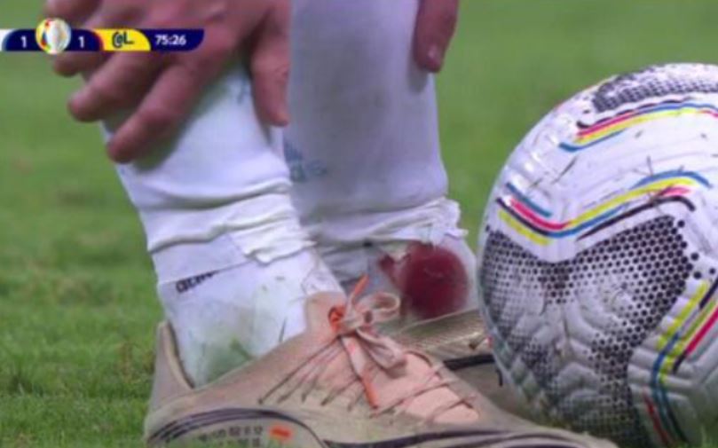 Argentina jogará com Brasil na final da Copa América; será a 4ª vez