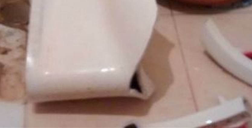 Mulher fica com vísceras expostas após vaso sanitário quebrar