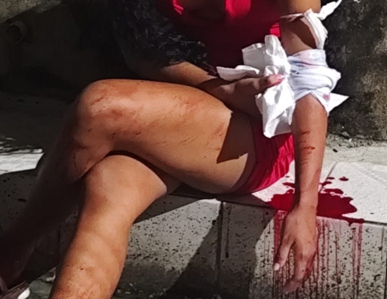 Homem é detido por populares suspeito de esfaquear companheira na Chapada