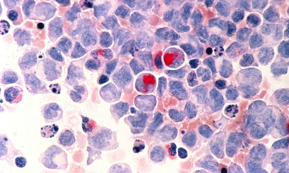 ANS inclui opções de quimioterapia oral em planos de Saúde