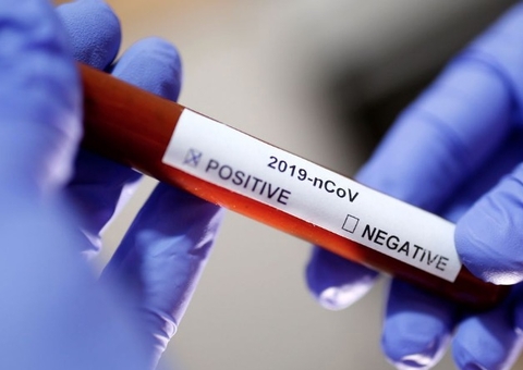 Amazonas registra 916 novos casos de Covid-19 nesta sexta-feira