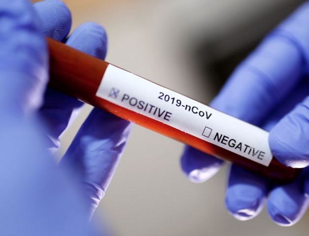 Amazonas registra 916 novos casos de Covid-19 nesta sexta-feira