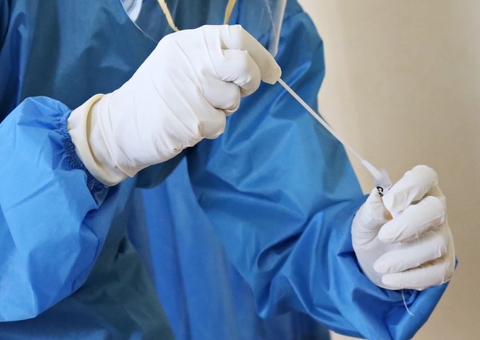 Com 763 novos casos, Amazonas tem 6 mortes por Covid-19 nas úlitmas 24h