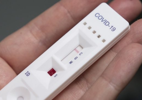 Menos de 10% da população fez teste de Covid-19 no Amazonas