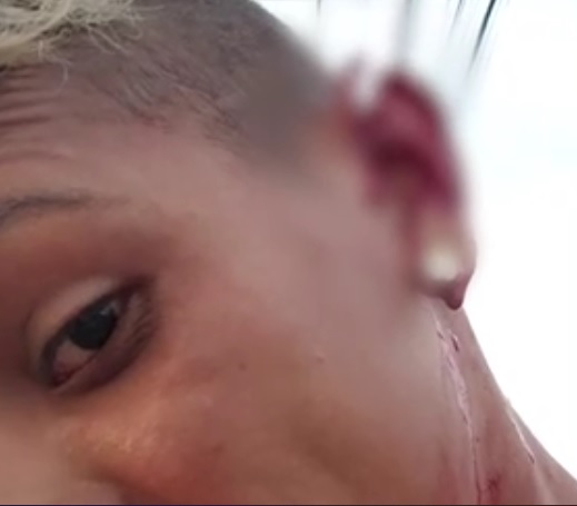 Gari tem orelha rasgada por morador durante briga por saco de lixo