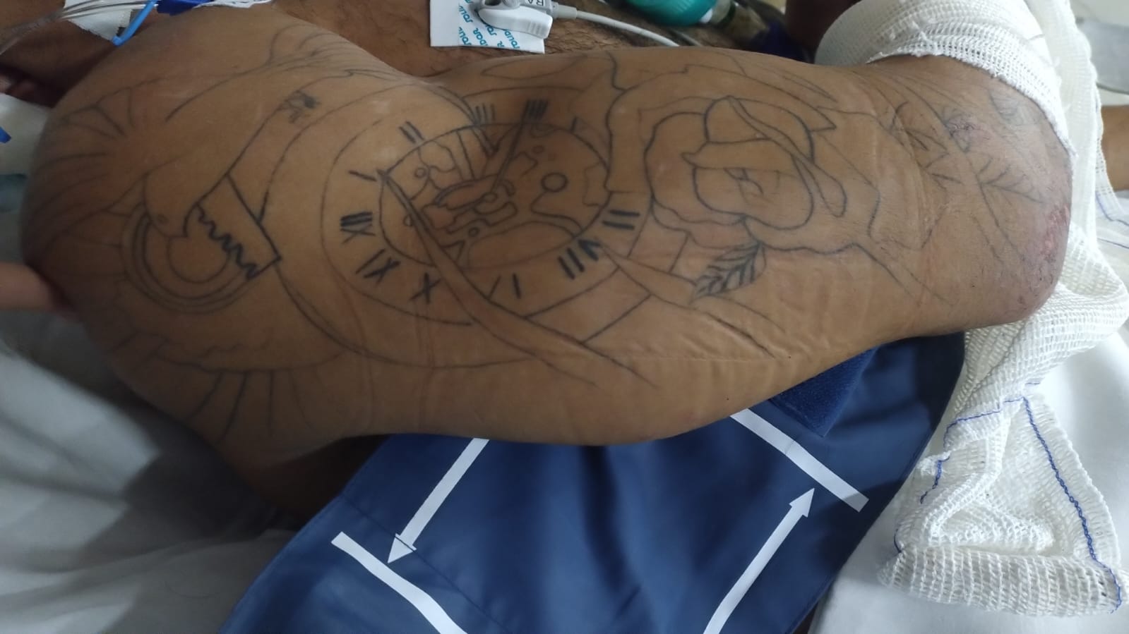 Hospital procura família de homem internado após sofrer agressão em Manaus