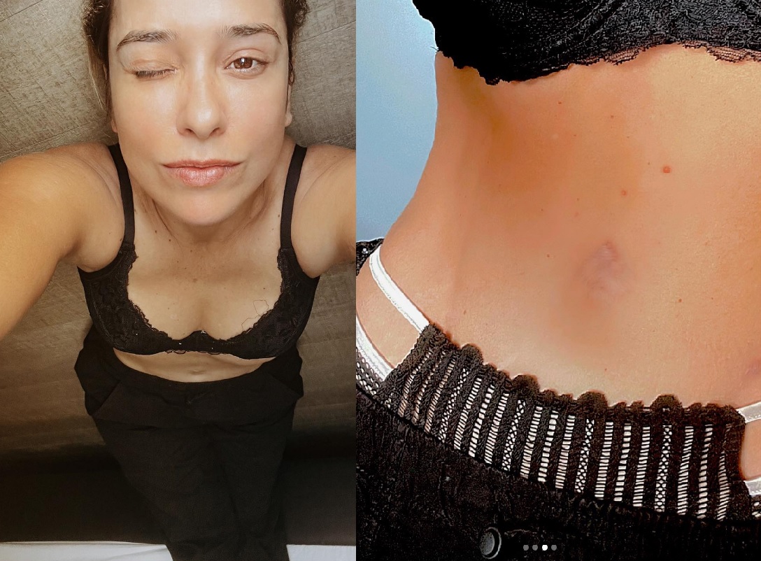 Paloma Duarte mostra fotos do corpo e revela: ‘não tenho umbigo’