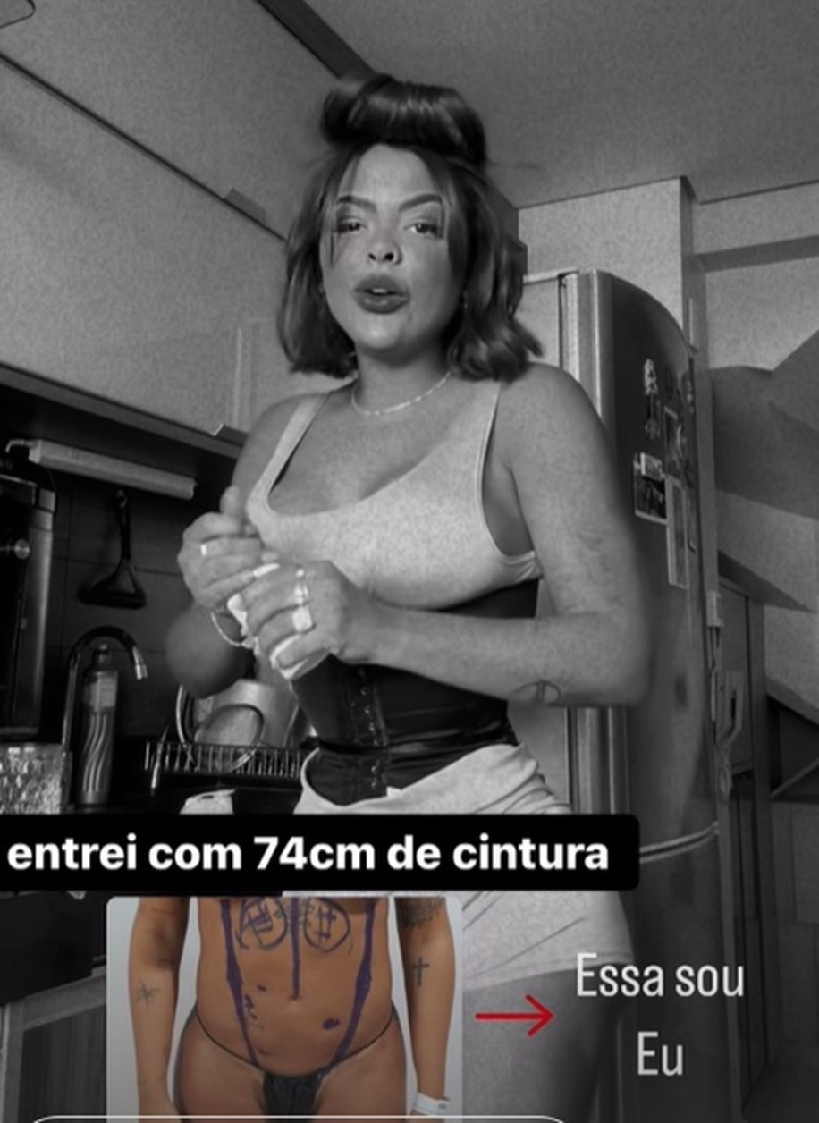 Ex-BBB Paula mostra resultado de cirurgia de 'remodelamento costal'