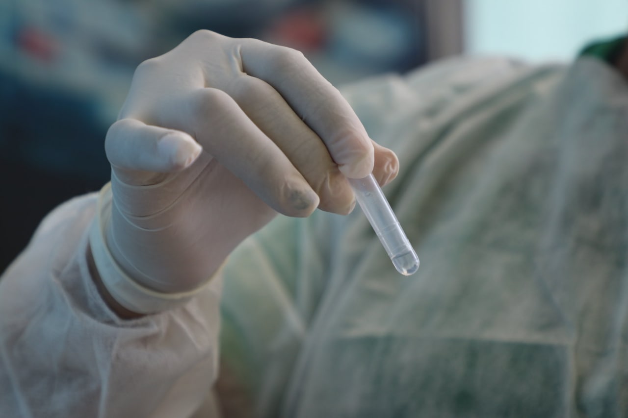 Amazonas tem 50 novos casos registrados de covid e confirma 1 óbito 