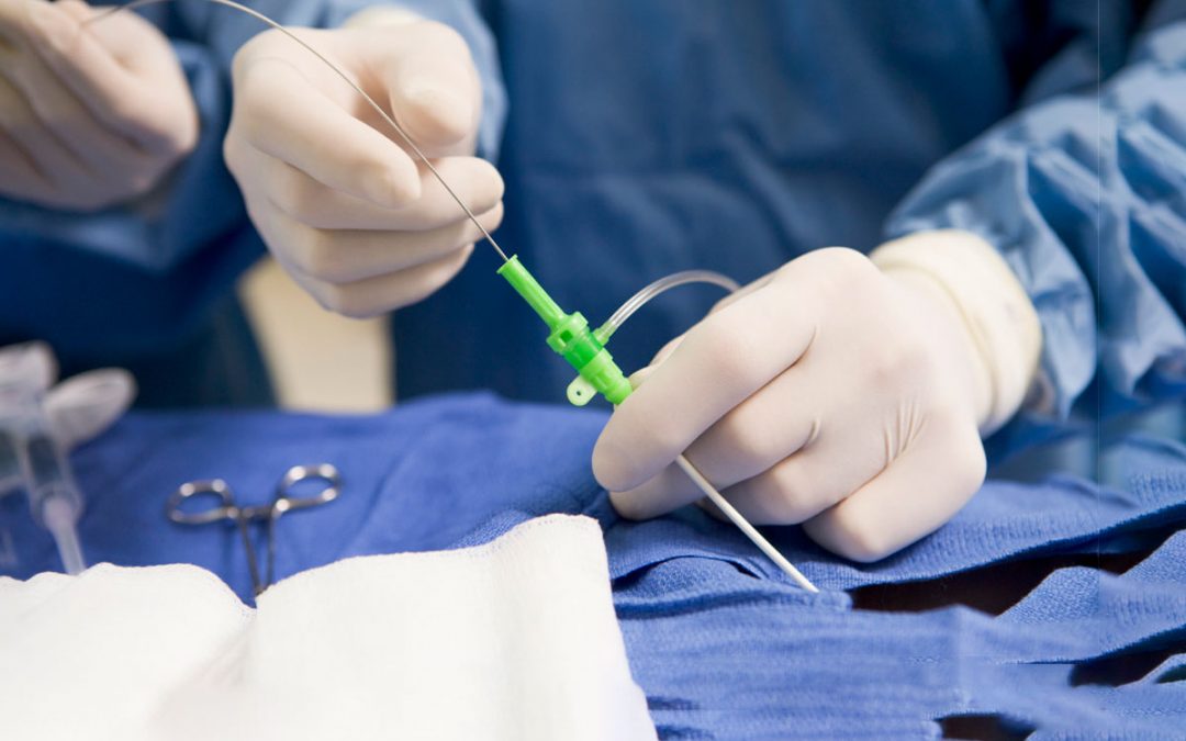 Mulher será indenizada por ficar mais de seis anos com cateter na bexiga