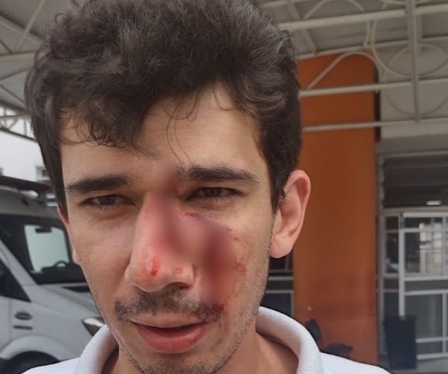 Vídeo: Funcionário de mercado é agredido com skate por pedir uso de máscara