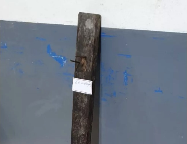 Mulher fica em estado grave após ser espancada a pauladas pelo marido 