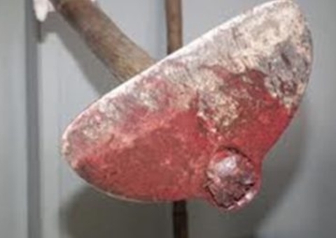 Funcionário de hospital é agredido a golpes de enxada por paciente