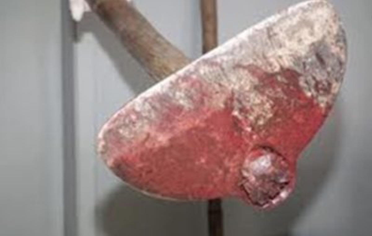 Funcionário de hospital é agredido a golpes de enxada por paciente