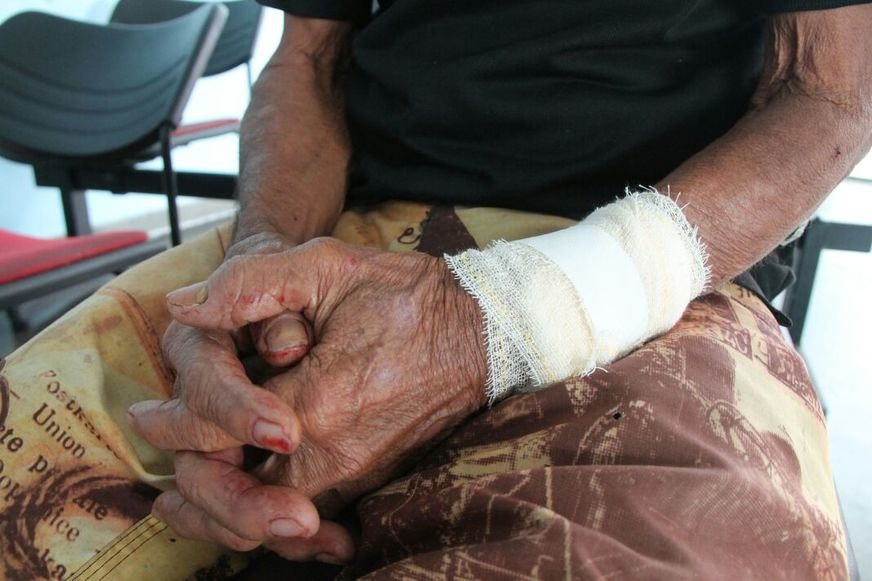 Genro bebe demais e espanca sogro de 62 anos